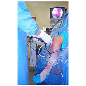 Total-Knee-Replacement