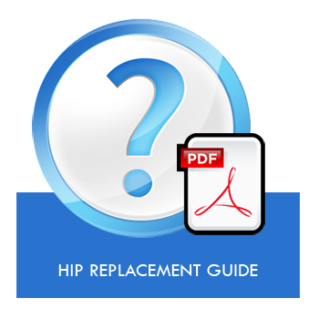 Hip Replacement Guide