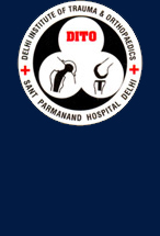 Knee Surgery Delhi