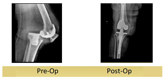 case-study4