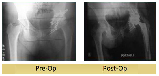 case-study4