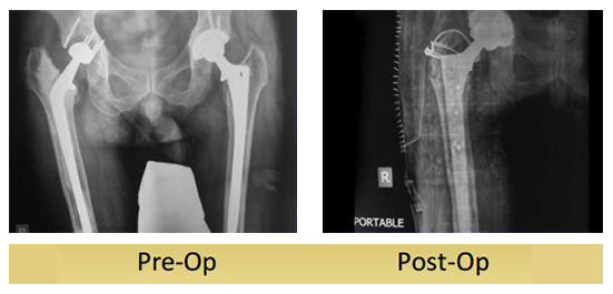 case-study4