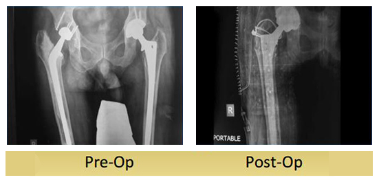 case-study4